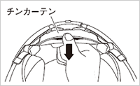 チンカーテンの取り外し